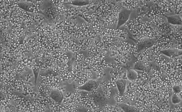 细胞污染 细胞污染